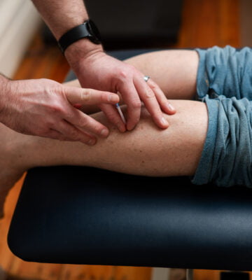 Photo of one of our podiatrists performing dry needling in Adelaide on a patient.