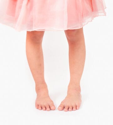 Legs of a young child with symptoms of intoeing.
